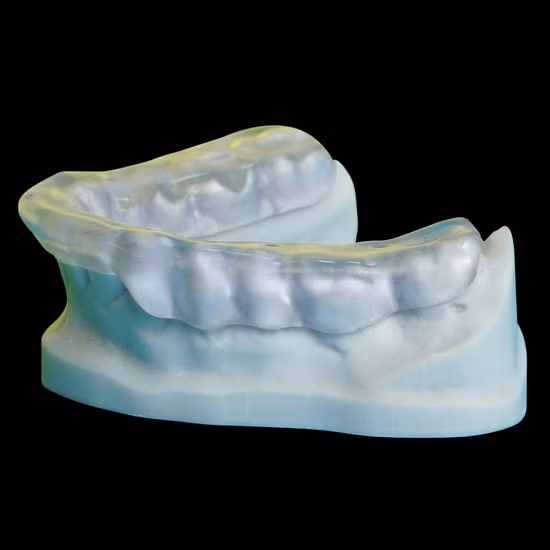 China Dental Lab Zahnkronen mit Rpd-Prothese