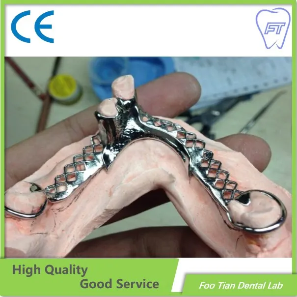 Gutes Produkt, herausnehmbare Metallgerüstprothese aus reinem Titan